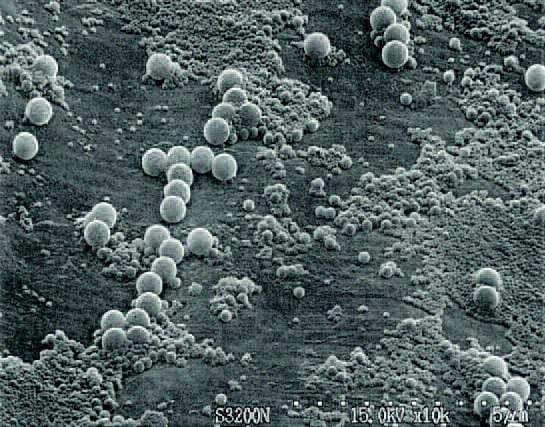 Electron Microscopic Image